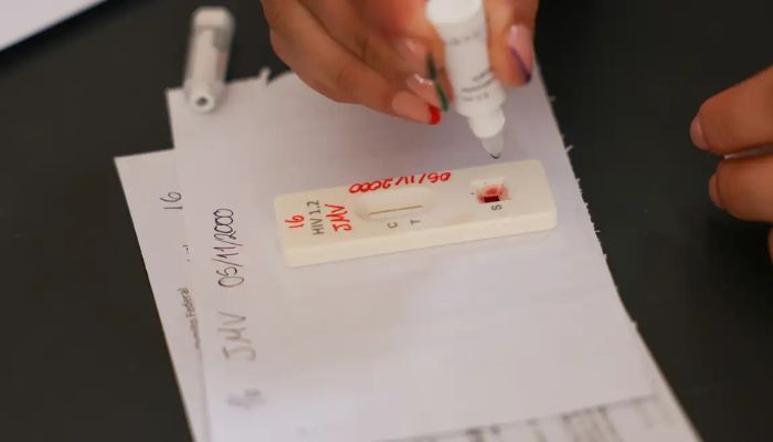 © Fabio Rodrigues-Pozzebom/ Agência Brasil Brasil celebra avanços neste Dia Mundial de Luta contra o HIV